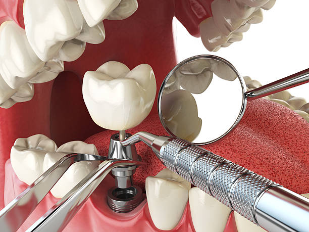 Best Emergency Dental Care for Trauma or Injury in Rancho Palos Verdes, CA